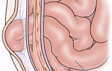 hogyan lehet gyógyítani az ízületi gyulladást a karon chondroprotektorok ízületi betegségek ízületi gyulladások és ízületi gyulladások kezelésére